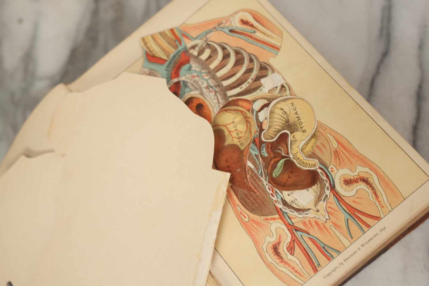 Lot 062 - "New Warren's Household Physician" Illustrated Antique Medical Reference Book With Layered Sectional Manikin Anatomical Illustrations, Debossed Woman's Bust On Cover, Other Full Color Plates, Published By A.I. Bradley & Company, Boston, 1904