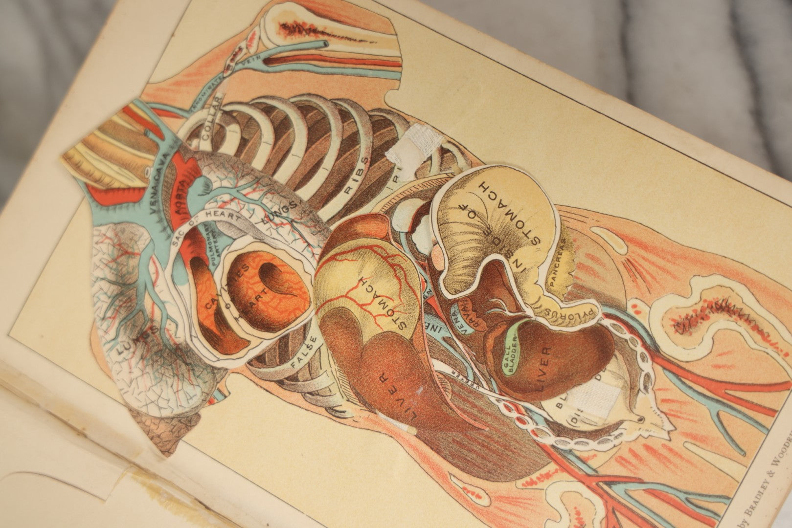 Lot 062 - "New Warren's Household Physician" Illustrated Antique Medical Reference Book With Layered Sectional Manikin Anatomical Illustrations, Debossed Woman's Bust On Cover, Other Full Color Plates, Published By A.I. Bradley & Company, Boston, 1904