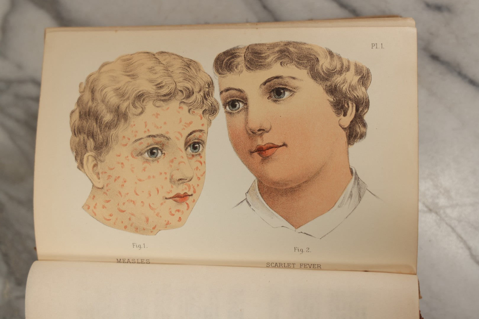 Lot 062 - "New Warren's Household Physician" Illustrated Antique Medical Reference Book With Layered Sectional Manikin Anatomical Illustrations, Debossed Woman's Bust On Cover, Other Full Color Plates, Published By A.I. Bradley & Company, Boston, 1904