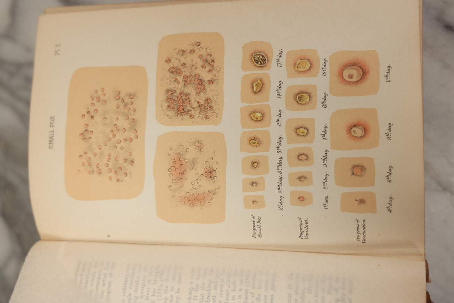 Lot 062 - "New Warren's Household Physician" Illustrated Antique Medical Reference Book With Layered Sectional Manikin Anatomical Illustrations, Debossed Woman's Bust On Cover, Other Full Color Plates, Published By A.I. Bradley & Company, Boston, 1904