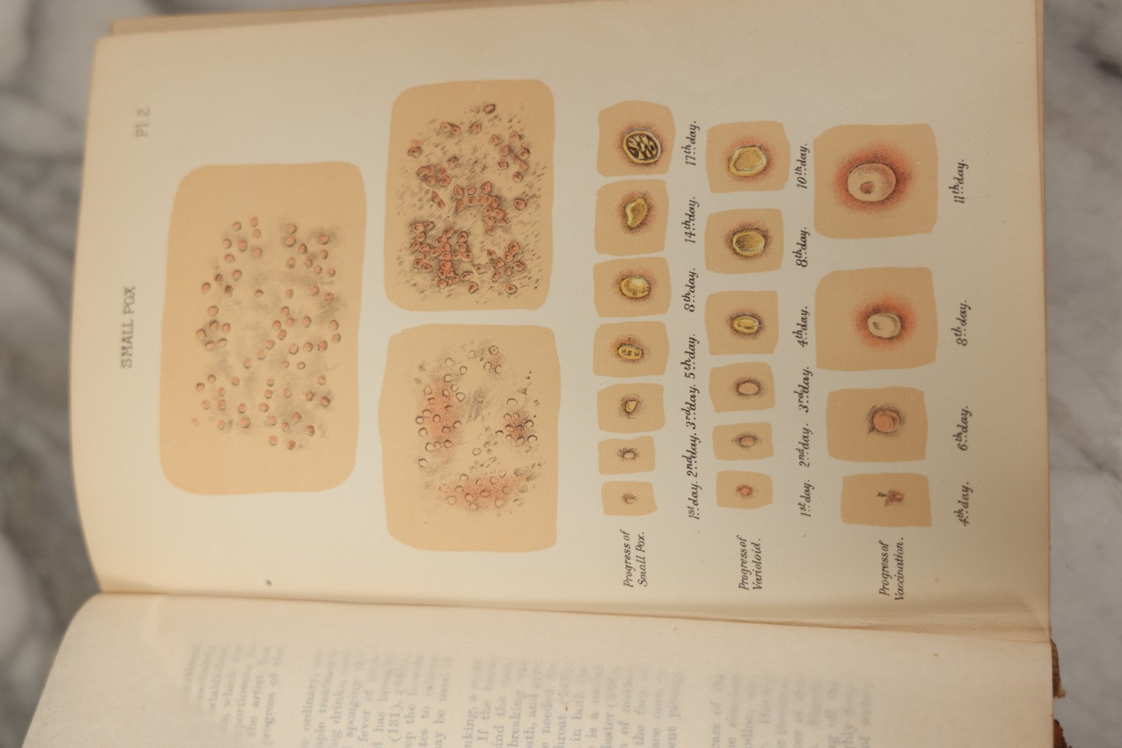 Lot 062 - "New Warren's Household Physician" Illustrated Antique Medical Reference Book With Layered Sectional Manikin Anatomical Illustrations, Debossed Woman's Bust On Cover, Other Full Color Plates, Published By A.I. Bradley & Company, Boston, 1904