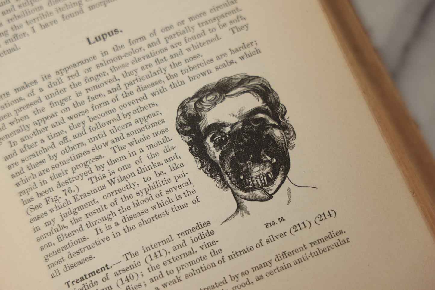 Lot 062 - "New Warren's Household Physician" Illustrated Antique Medical Reference Book With Layered Sectional Manikin Anatomical Illustrations, Debossed Woman's Bust On Cover, Other Full Color Plates, Published By A.I. Bradley & Company, Boston, 1904