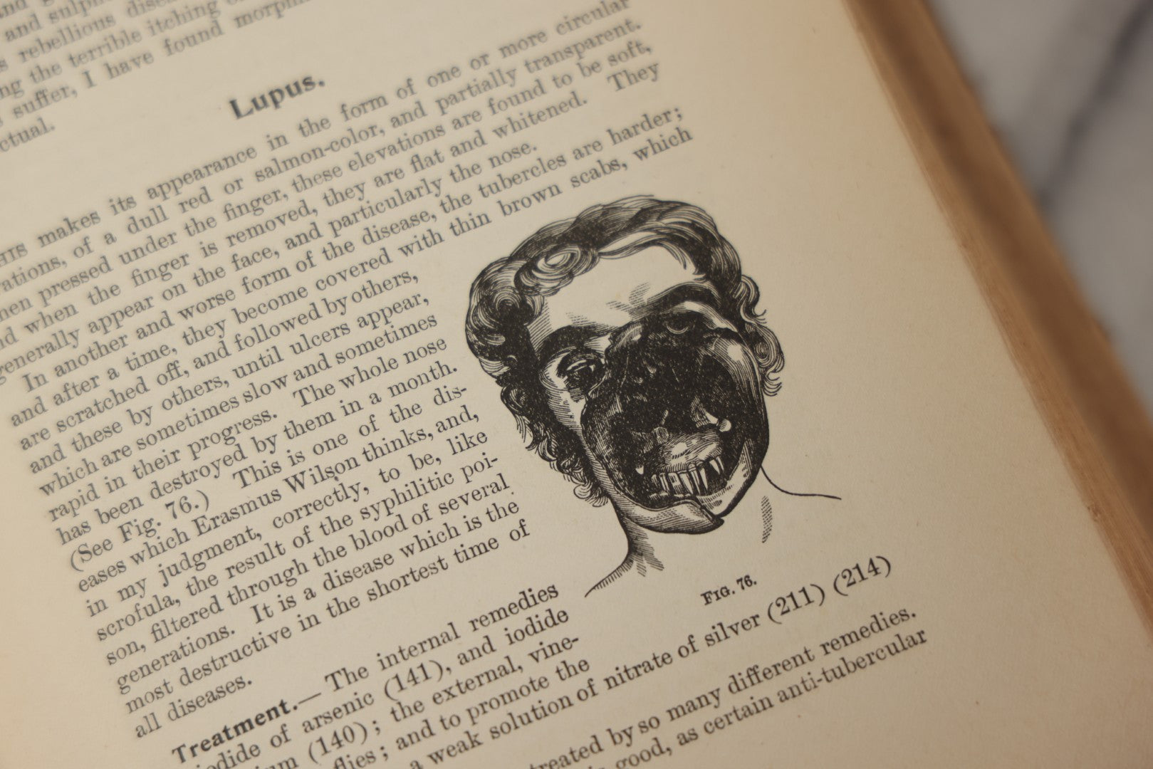 Lot 062 - "New Warren's Household Physician" Illustrated Antique Medical Reference Book With Layered Sectional Manikin Anatomical Illustrations, Debossed Woman's Bust On Cover, Other Full Color Plates, Published By A.I. Bradley & Company, Boston, 1904