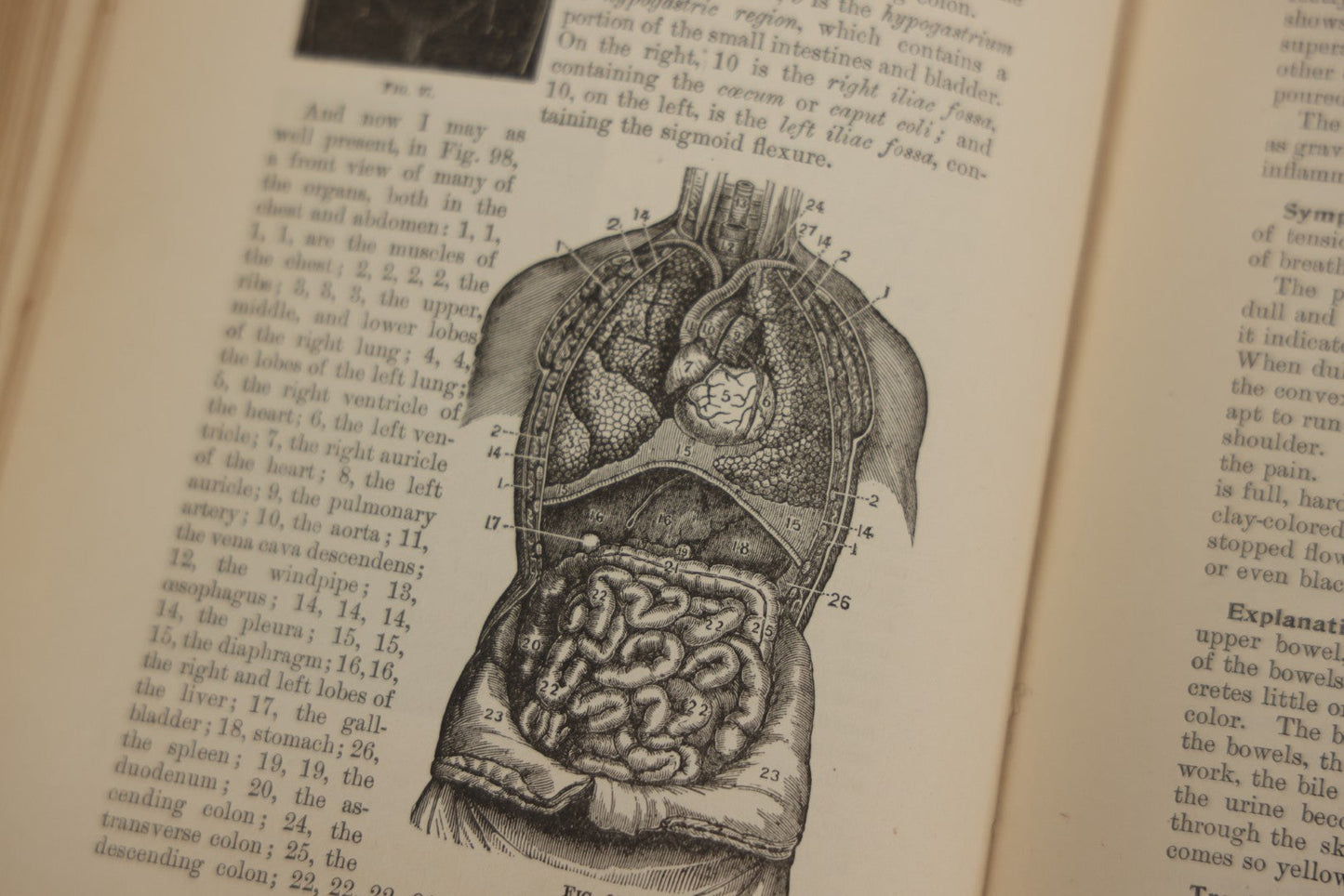 Lot 062 - "New Warren's Household Physician" Illustrated Antique Medical Reference Book With Layered Sectional Manikin Anatomical Illustrations, Debossed Woman's Bust On Cover, Other Full Color Plates, Published By A.I. Bradley & Company, Boston, 1904