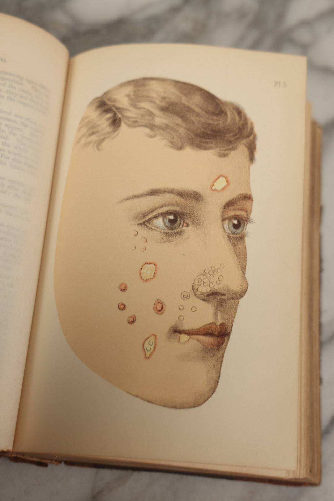 Lot 062 - "New Warren's Household Physician" Illustrated Antique Medical Reference Book With Layered Sectional Manikin Anatomical Illustrations, Debossed Woman's Bust On Cover, Other Full Color Plates, Published By A.I. Bradley & Company, Boston, 1904