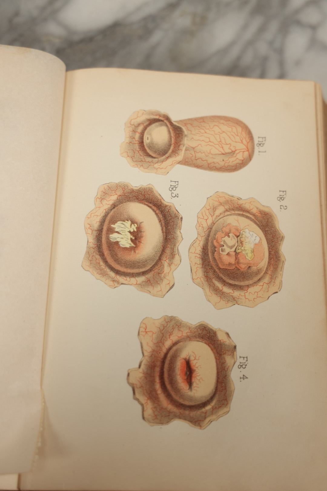 Lot 062 - "New Warren's Household Physician" Illustrated Antique Medical Reference Book With Layered Sectional Manikin Anatomical Illustrations, Debossed Woman's Bust On Cover, Other Full Color Plates, Published By A.I. Bradley & Company, Boston, 1904
