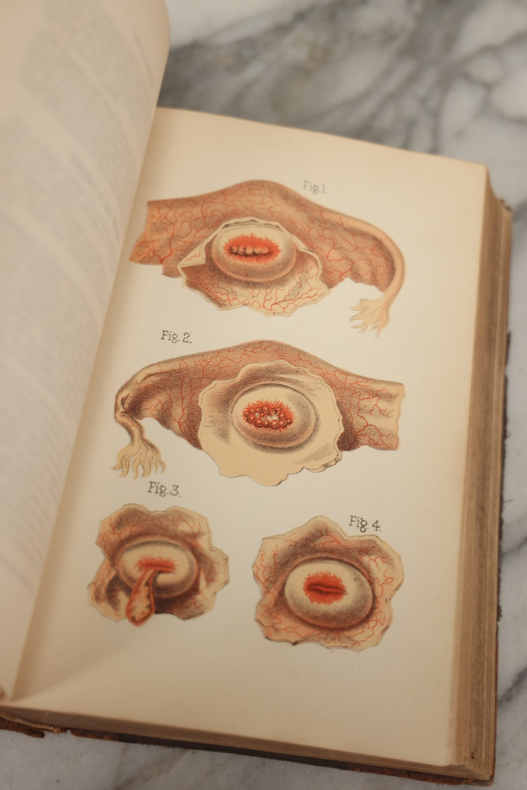 Lot 062 - "New Warren's Household Physician" Illustrated Antique Medical Reference Book With Layered Sectional Manikin Anatomical Illustrations, Debossed Woman's Bust On Cover, Other Full Color Plates, Published By A.I. Bradley & Company, Boston, 1904