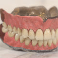 Lot 038 - Pair Of Vintage Dentures With Resin Teeth On Metal Dental Plate