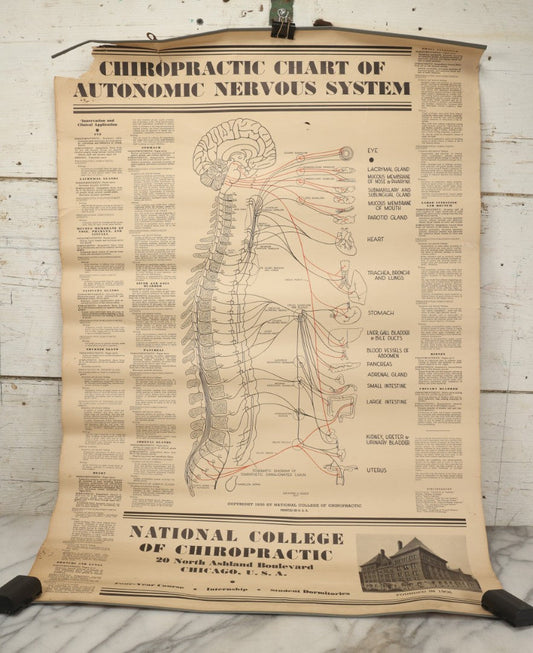 Lot 235 - Vintage Advertising Poster “Chiropractic Chart Of Autonomic Nervous System,” National College Of Chiropractic, Chicago, Illinois, 1938, Note Poor Condition 24" x 35-1/2"