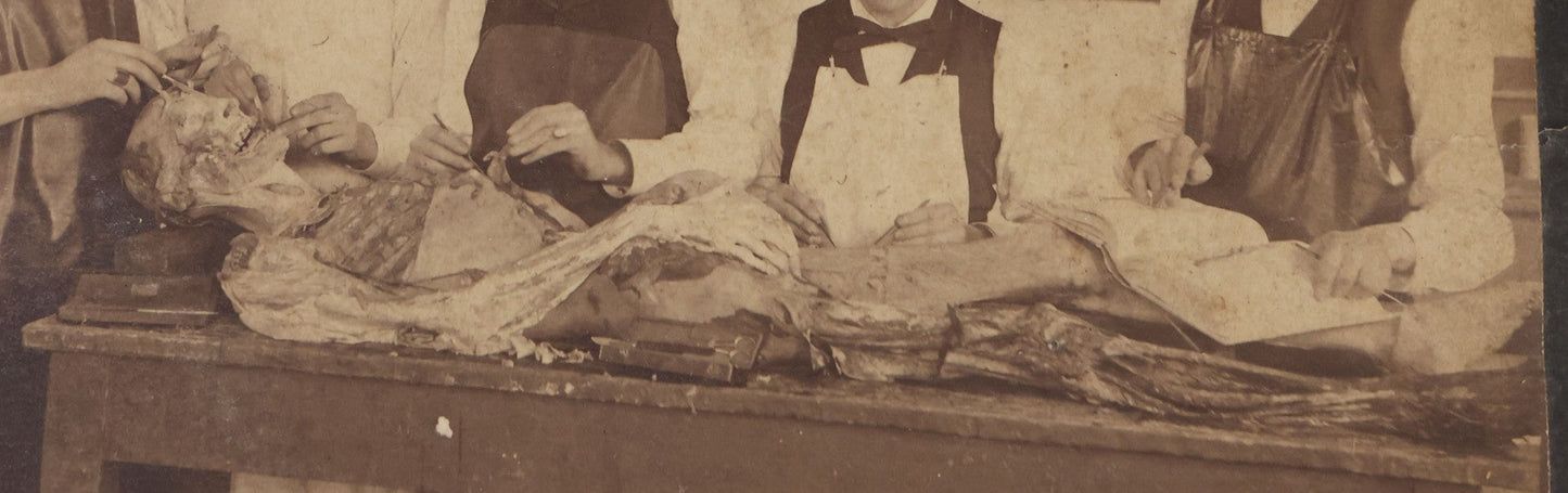 Lot 004 - Antique Boudoir-Sized Cabinet Card Photograph Of Medical Students With Dissection Table And Cadaver, Late 19th Century