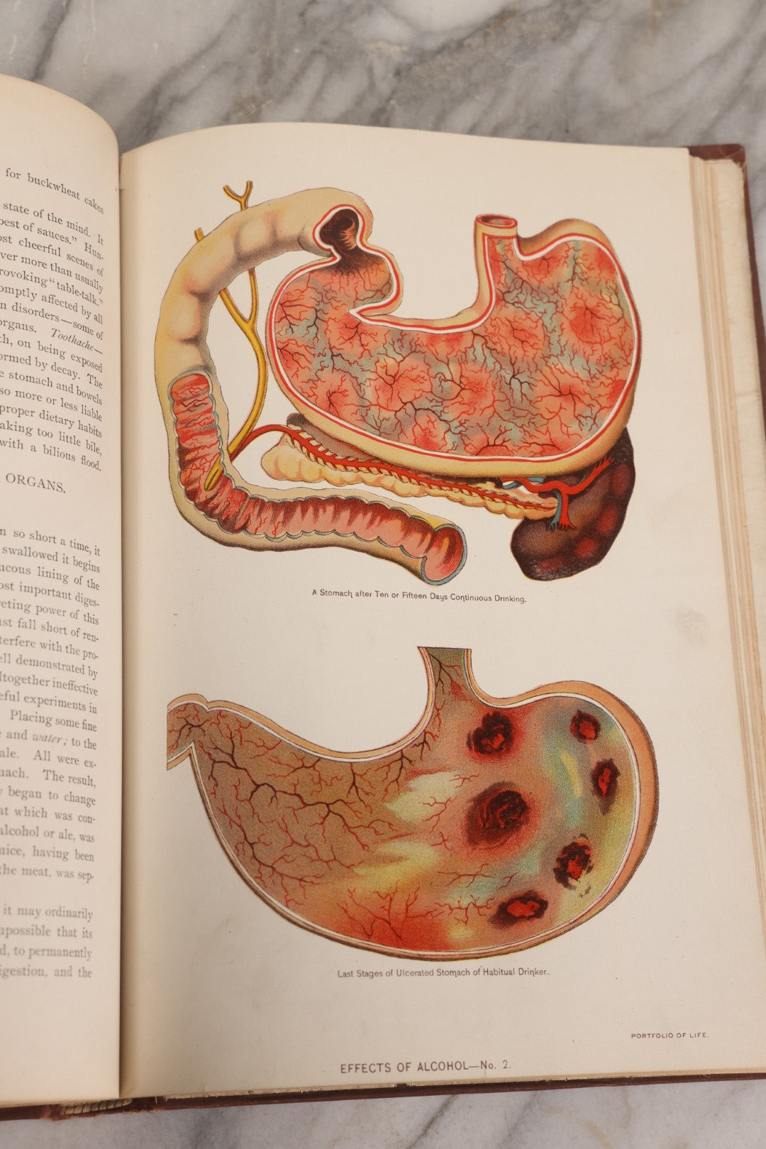 Lot 008 - "Portfolio Of Life; Or, A Popular Study Of The House In Which We Live" Antique Physiology Book By Prof. Henry H. Rassweiler, Illustrated With Anatomical Plates And Manikins, Published By Pacific Publishing Co.