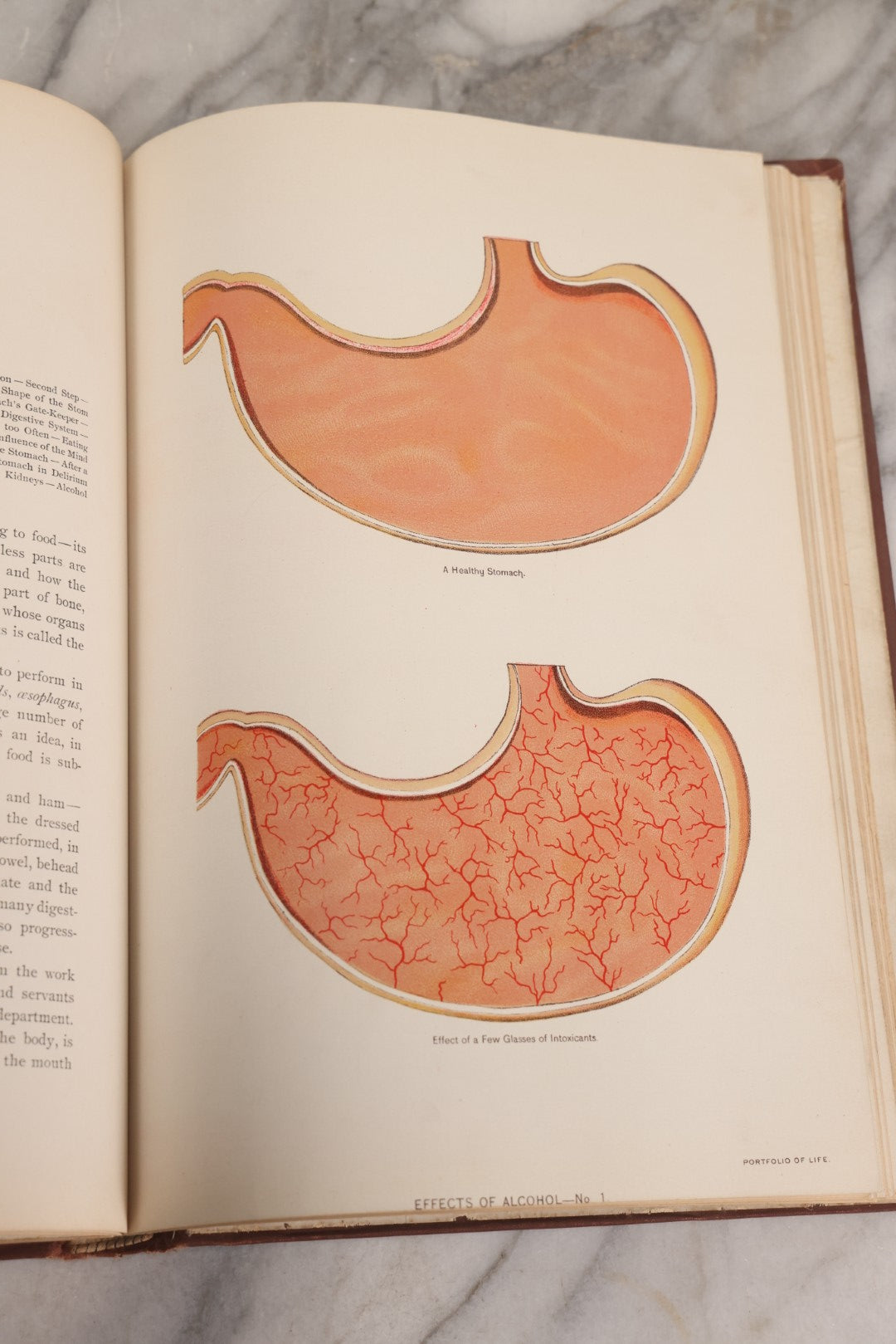 Lot 008 - "Portfolio Of Life; Or, A Popular Study Of The House In Which We Live" Antique Physiology Book By Prof. Henry H. Rassweiler, Illustrated With Anatomical Plates And Manikins, Published By Pacific Publishing Co.