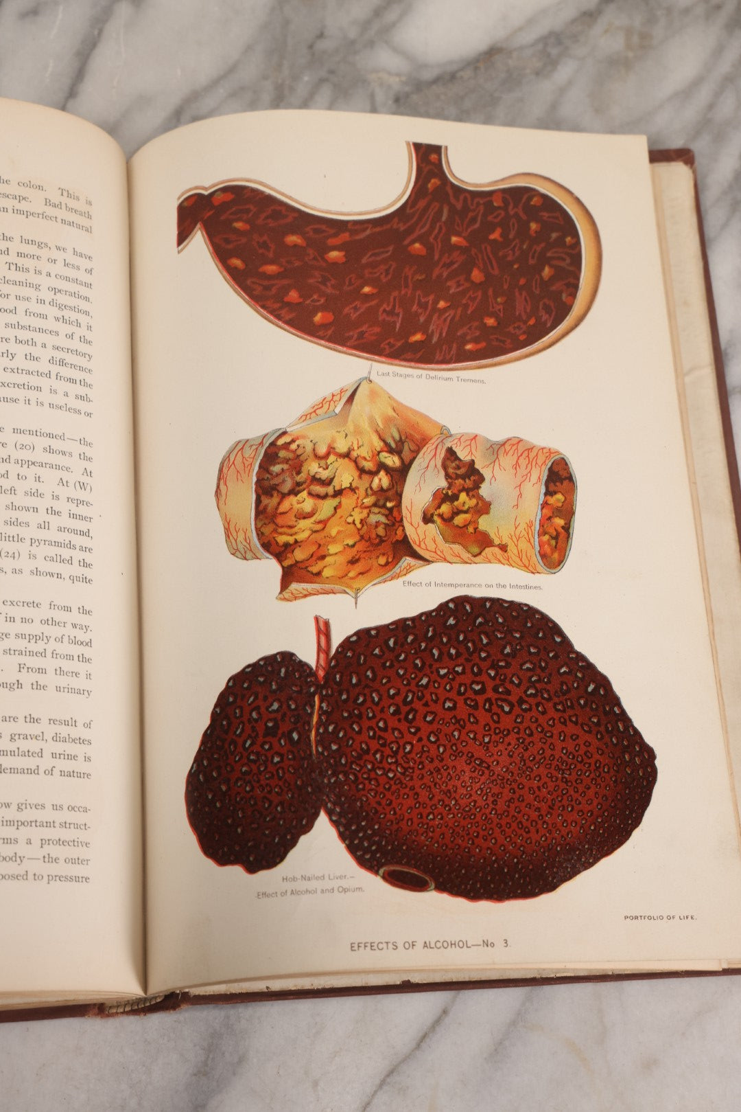 Lot 008 - "Portfolio Of Life; Or, A Popular Study Of The House In Which We Live" Antique Physiology Book By Prof. Henry H. Rassweiler, Illustrated With Anatomical Plates And Manikins, Published By Pacific Publishing Co.