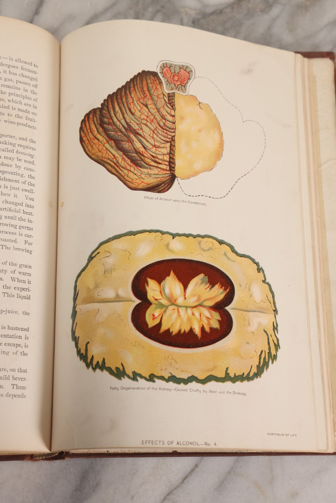 Lot 008 - "Portfolio Of Life; Or, A Popular Study Of The House In Which We Live" Antique Physiology Book By Prof. Henry H. Rassweiler, Illustrated With Anatomical Plates And Manikins, Published By Pacific Publishing Co.
