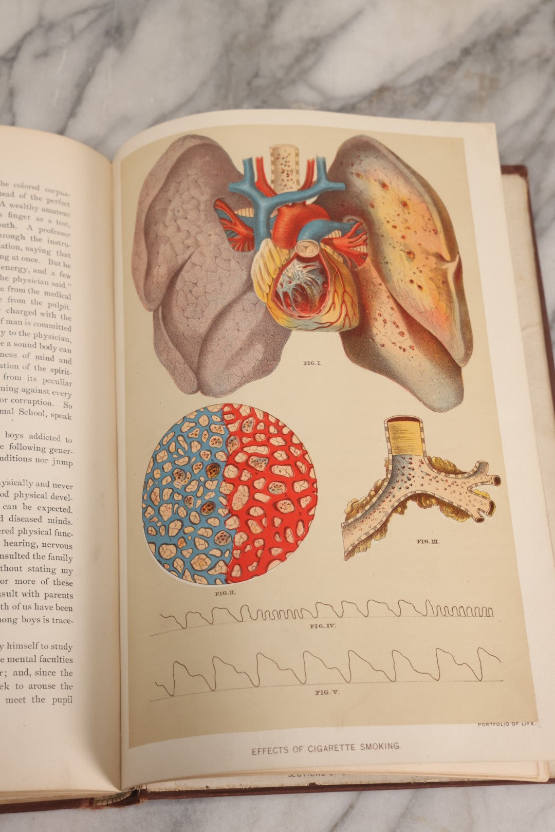 Lot 008 - "Portfolio Of Life; Or, A Popular Study Of The House In Which We Live" Antique Physiology Book By Prof. Henry H. Rassweiler, Illustrated With Anatomical Plates And Manikins, Published By Pacific Publishing Co.