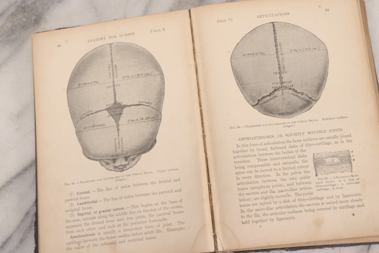 Lot 009 - "Text-Book Of Anatomy And Physiology For Nurses" Antique Medical Textbook By Diana Clifford Kimber, Illustrated, Third Edition Revised By Carolyn E. Gray, Published By The Macmillan Company, New York, 1912