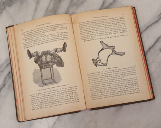 Lot 233 - "The Diseases Of Women" Antique Gynecology And Obstetrics Medical Book By Heinrich Fritsch, Translated By Isidor Furst, Published By William Wood & Company, New York, 1883, With 159 Wood Engravings