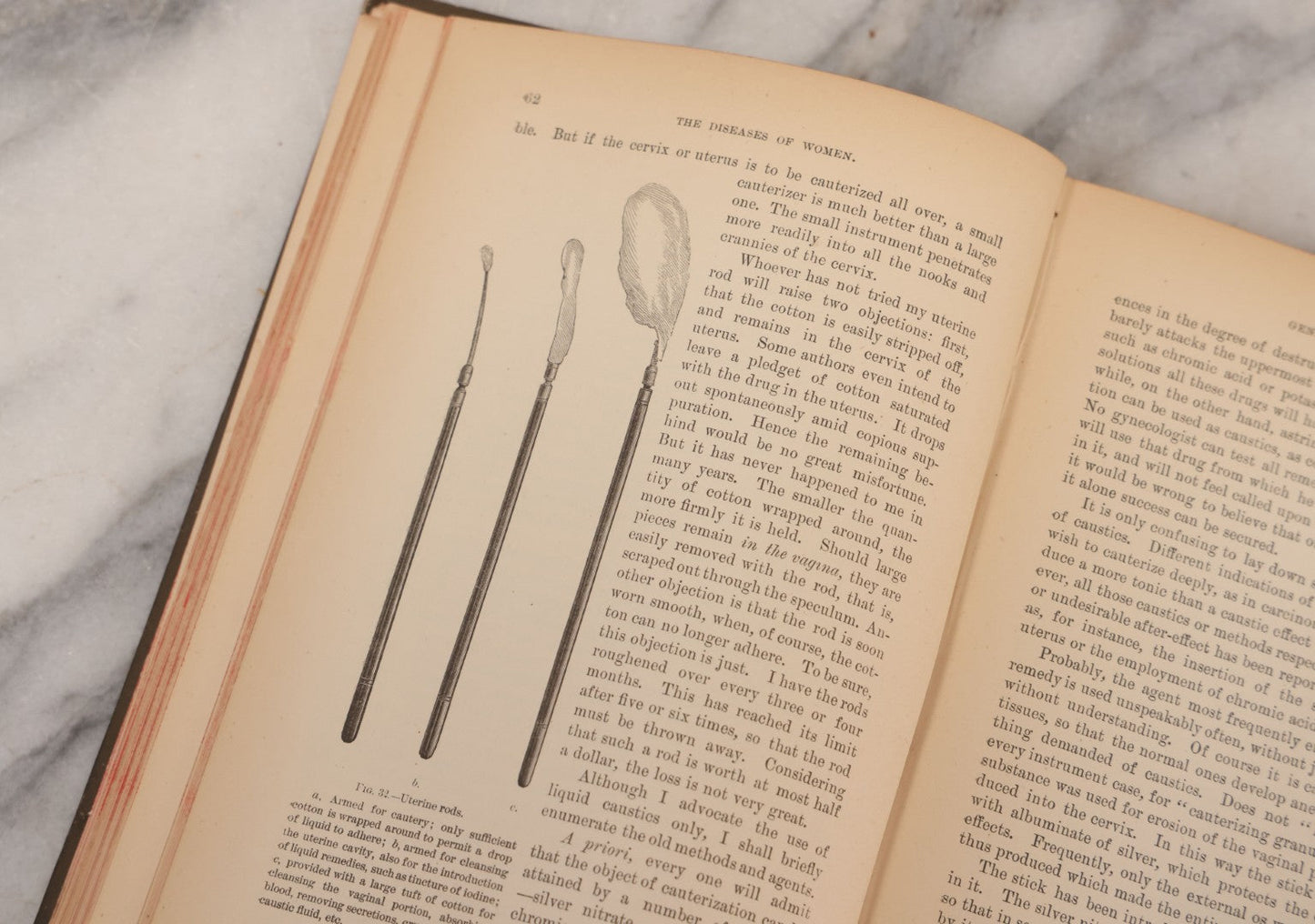 Lot 233 - "The Diseases Of Women" Antique Gynecology And Obstetrics Medical Book By Heinrich Fritsch, Translated By Isidor Furst, Published By William Wood & Company, New York, 1883, With 159 Wood Engravings