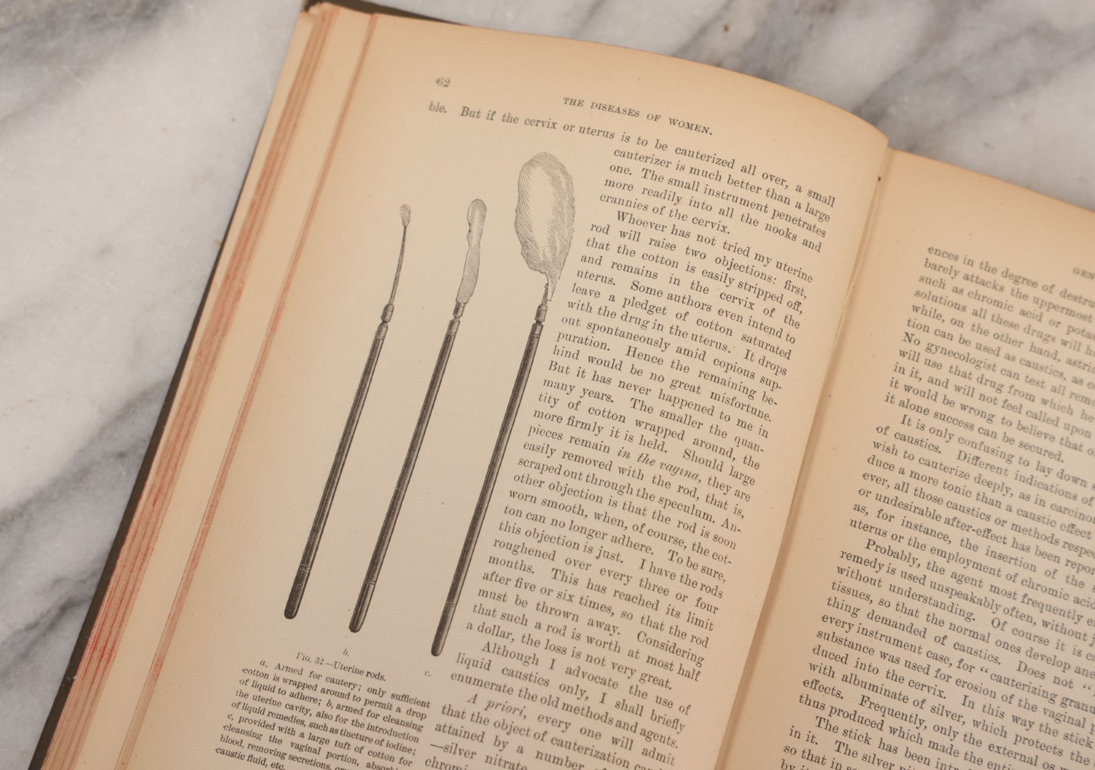 Lot 233 - "The Diseases Of Women" Antique Gynecology And Obstetrics Medical Book By Heinrich Fritsch, Translated By Isidor Furst, Published By William Wood & Company, New York, 1883, With 159 Wood Engravings