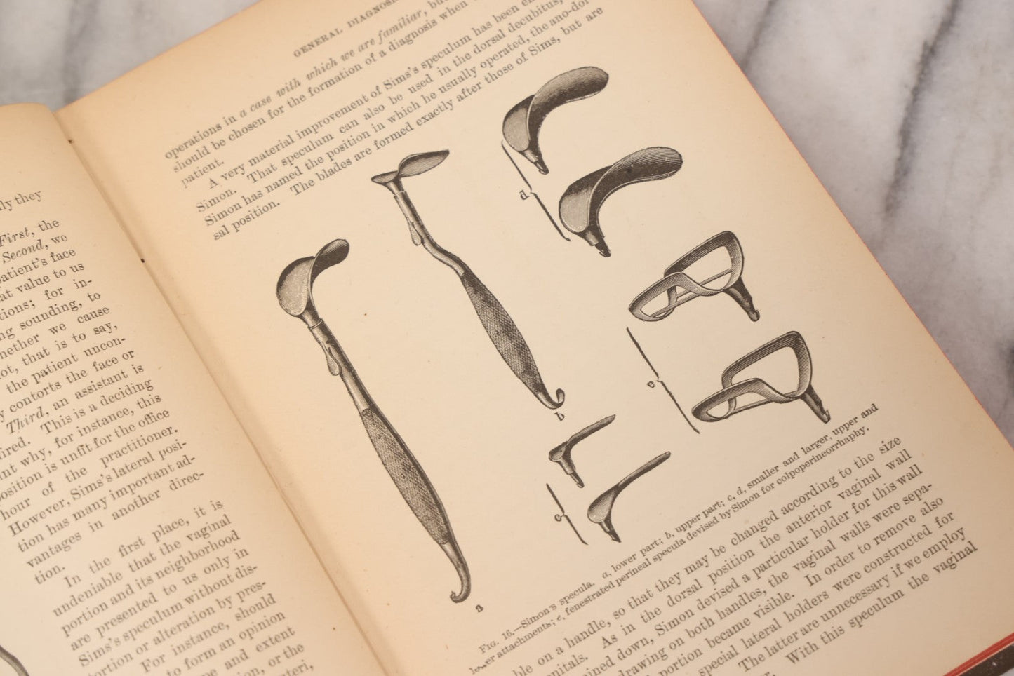 Lot 233 - "The Diseases Of Women" Antique Gynecology And Obstetrics Medical Book By Heinrich Fritsch, Translated By Isidor Furst, Published By William Wood & Company, New York, 1883, With 159 Wood Engravings