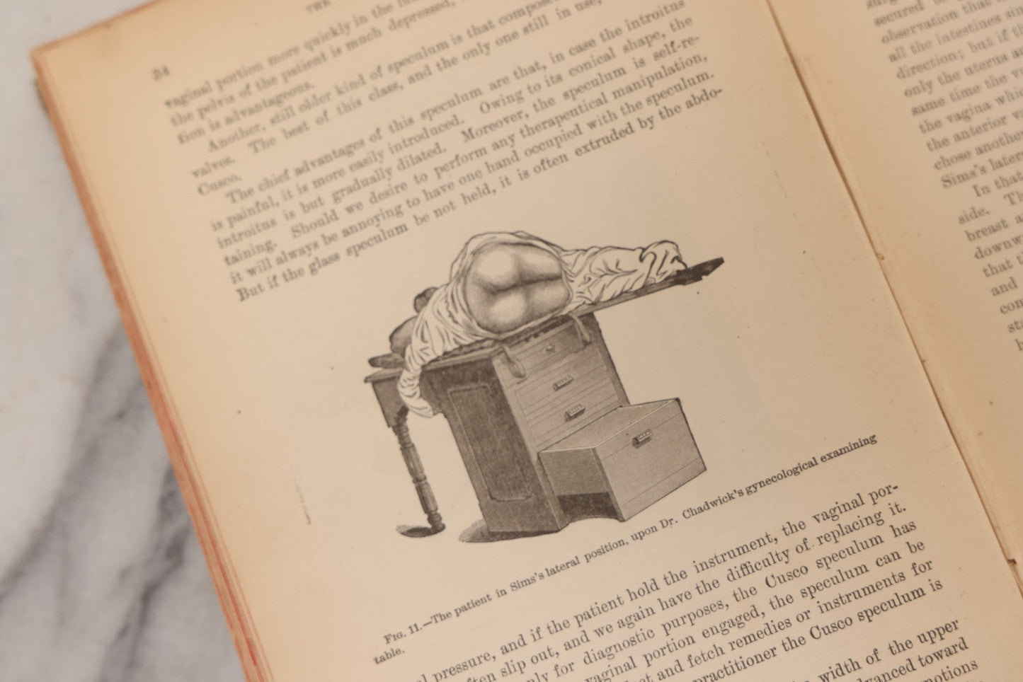 Lot 233 - "The Diseases Of Women" Antique Gynecology And Obstetrics Medical Book By Heinrich Fritsch, Translated By Isidor Furst, Published By William Wood & Company, New York, 1883, With 159 Wood Engravings