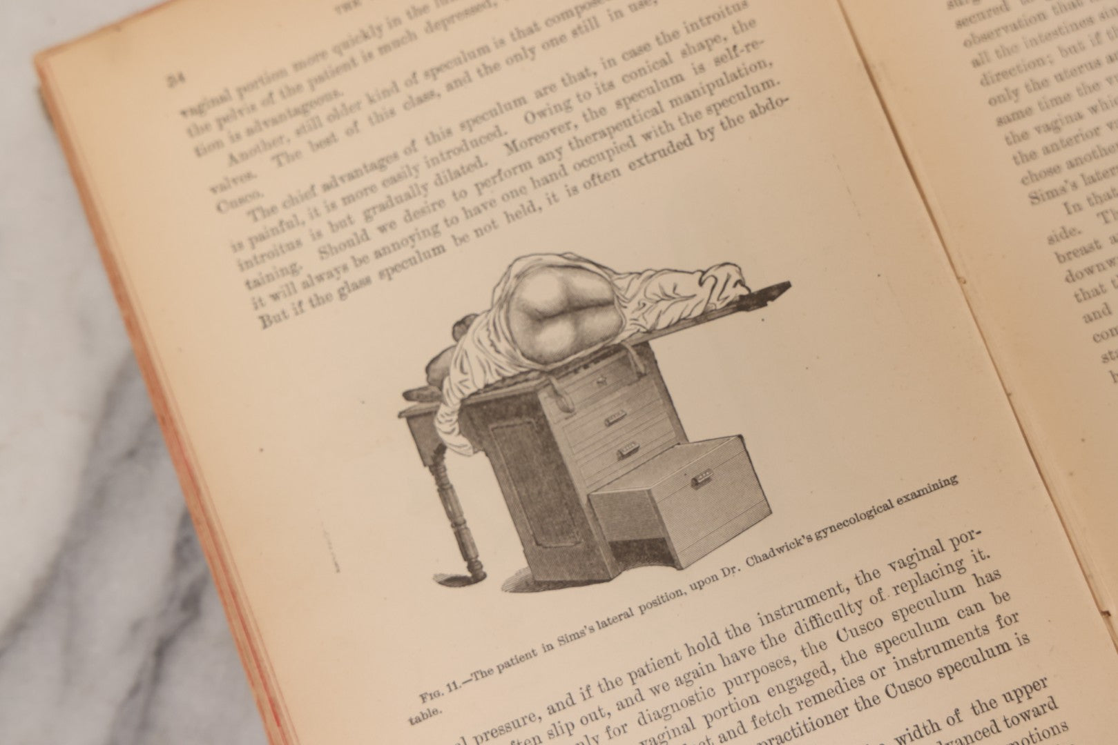 Lot 233 - "The Diseases Of Women" Antique Gynecology And Obstetrics Medical Book By Heinrich Fritsch, Translated By Isidor Furst, Published By William Wood & Company, New York, 1883, With 159 Wood Engravings