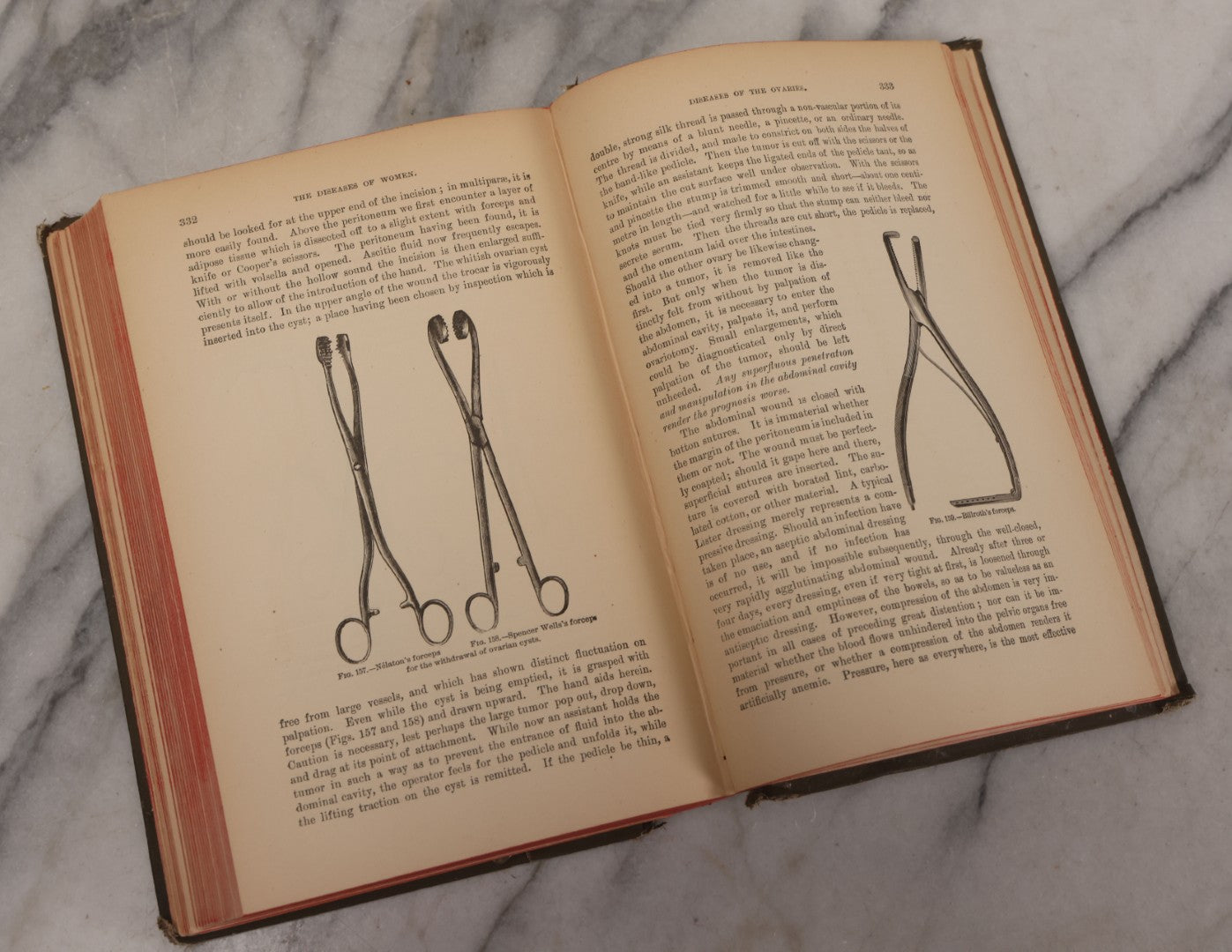 Lot 233 - "The Diseases Of Women" Antique Gynecology And Obstetrics Medical Book By Heinrich Fritsch, Translated By Isidor Furst, Published By William Wood & Company, New York, 1883, With 159 Wood Engravings
