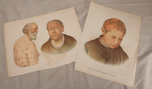 Lot 230 - Pair Of Antique Medical Chromolithograph Book Plate Prints, "Leprosy" And "Kerion And Ringworm Of Head," Lea Brothers & Co., Lithographed By T. Sinclair & Son, Philadelphia, Pennsylvania