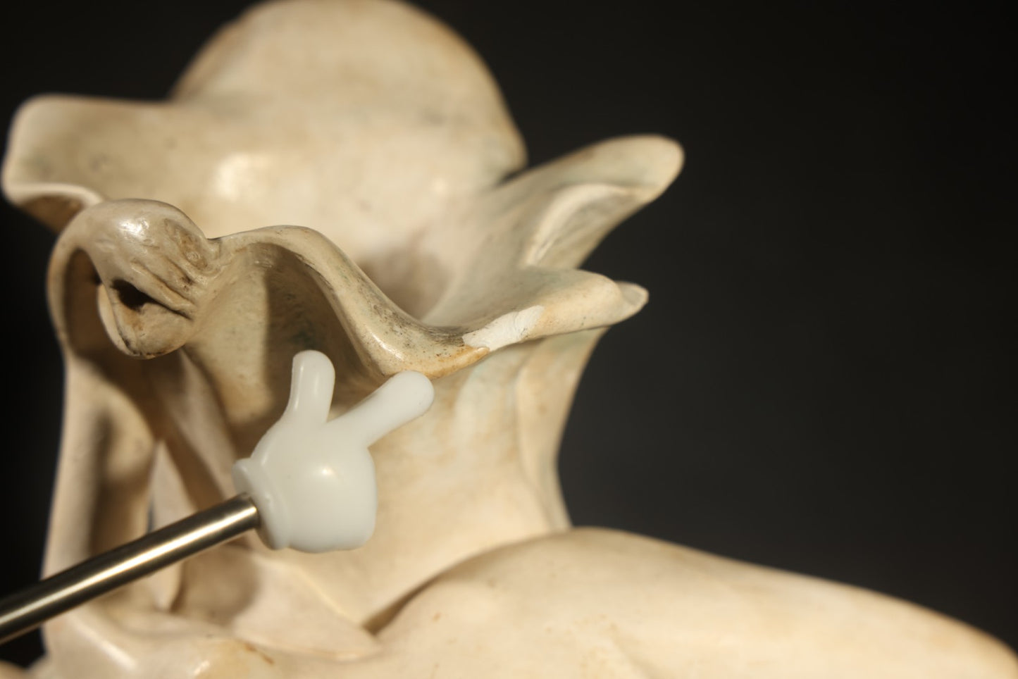 Antique Art Nouveau Figural Vase with Reclining Nude Female Figure and Floral Form, Plaster or Similar Material, Note Chips