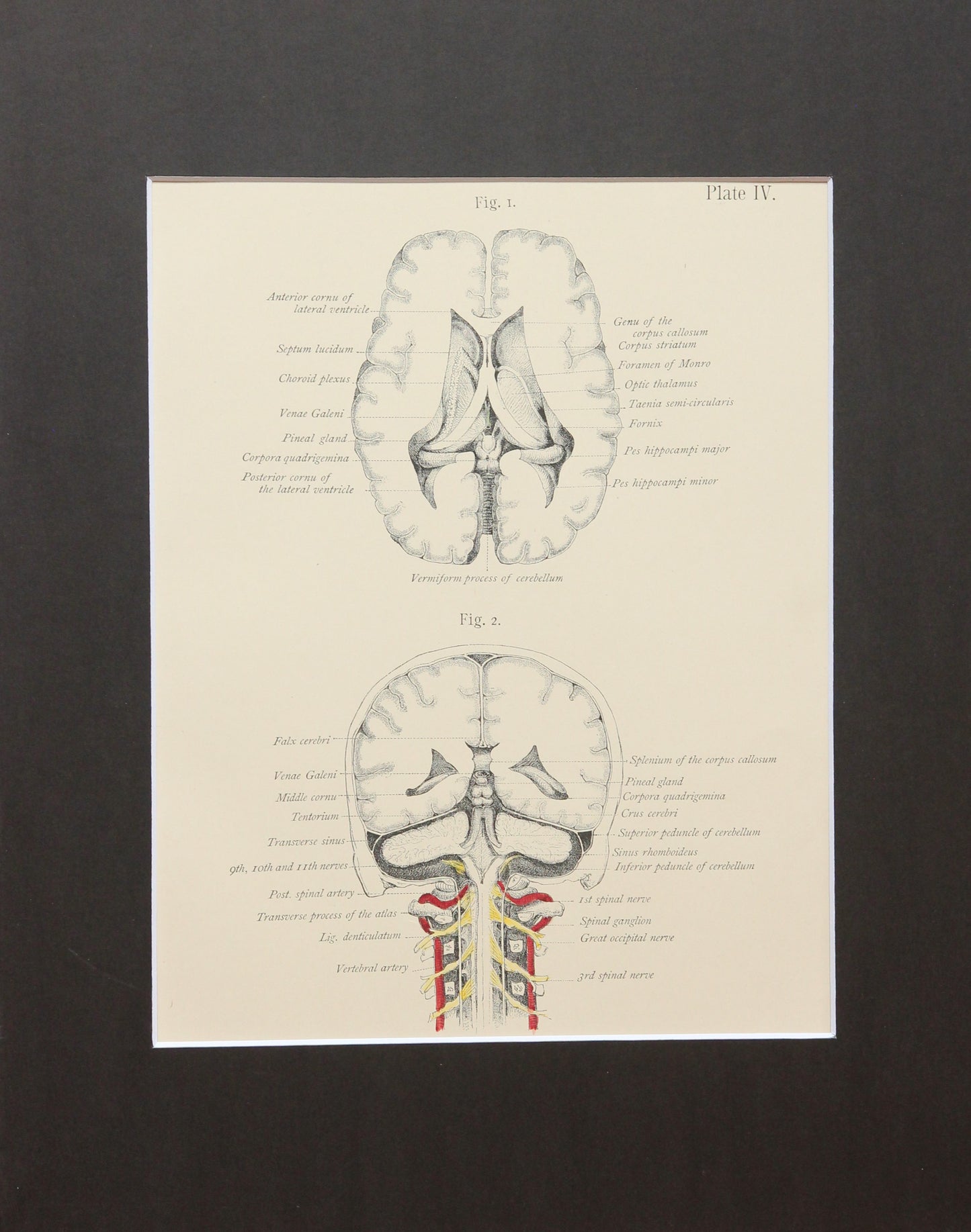 Matted Antique (c.1897) Anatomy Print, Plate IV: Brain Posterior