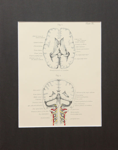 Matted Antique (c.1897) Anatomy Print, Plate IV: Brain Posterior