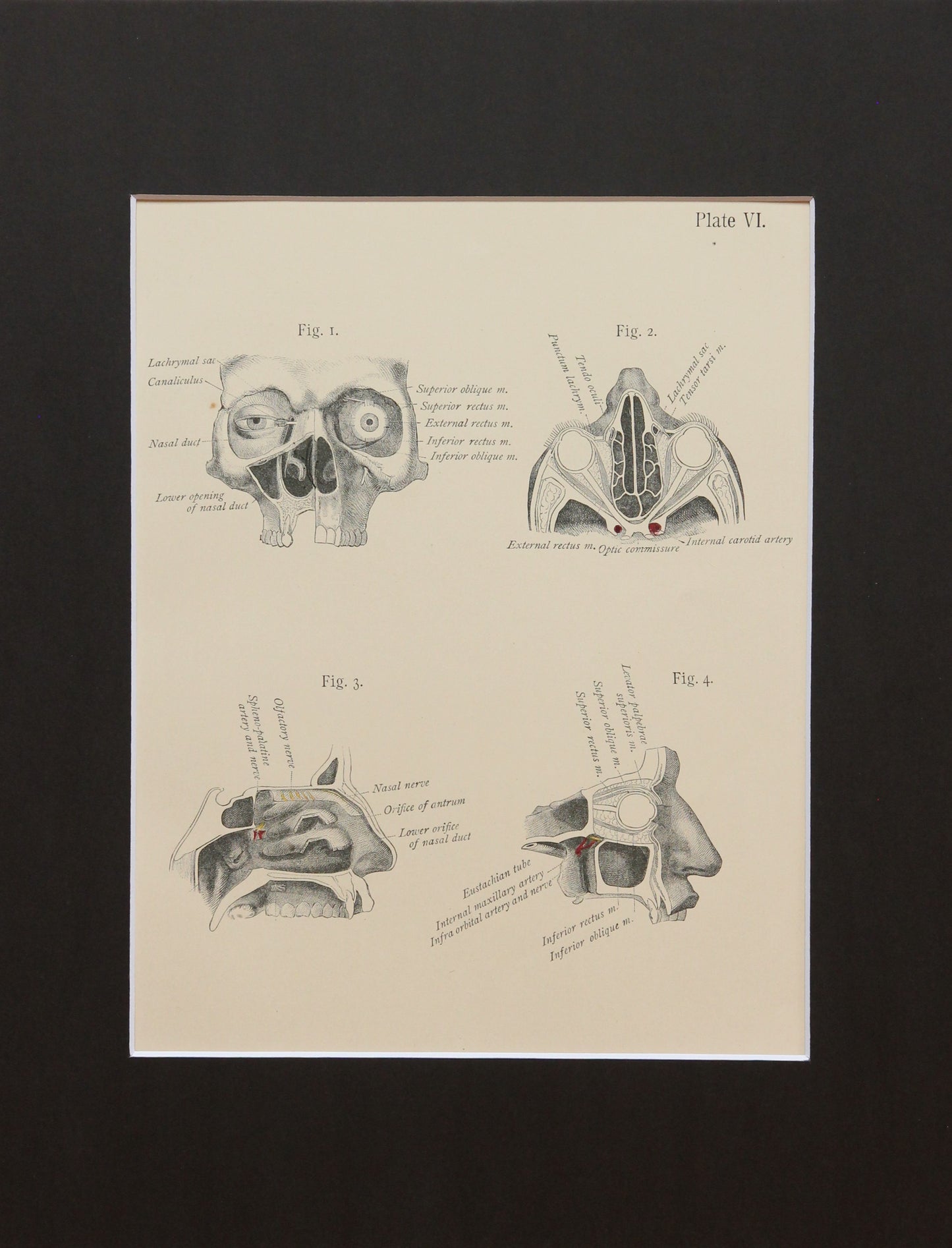 Matted Antique (c.1897) Anatomy Print, Plate VI: Orbits and Maxillary Bones