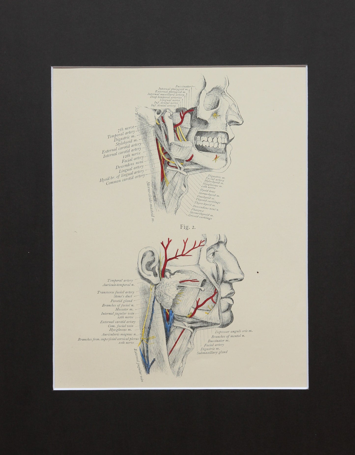 Matted Antique (c.1897) Anatomy Print, Plate XI: Dissection of the Neck