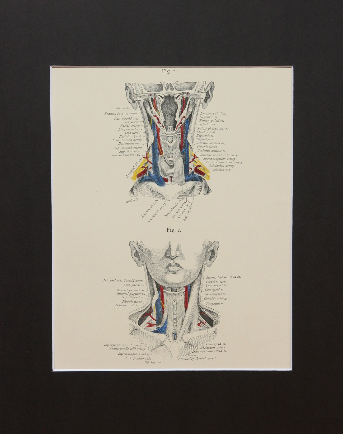 Matted Antique (c.1897) Anatomy Print, Plate XVII: The Neck