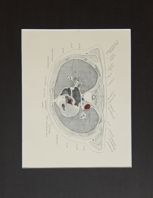 Matted Antique (c.1897) Anatomy Print, Plate XXV: The Thorax, Horizontal Section