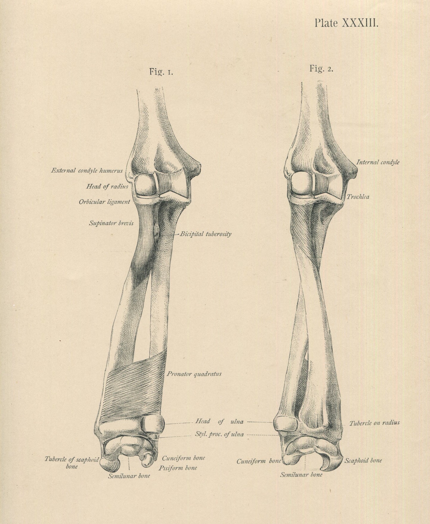 Matted Antique (c.1897) Anatomy Print, Plate XXXIII: The Bones of the Forearm