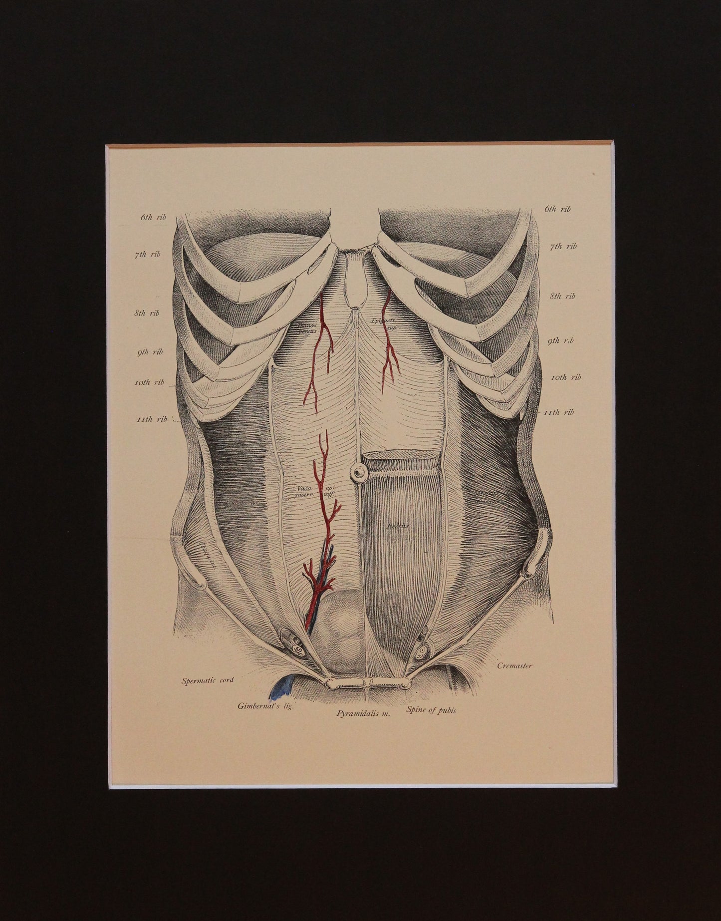 Matted Antique (c.1897) Anatomy Print, Plate XLVI: Anterior Abdominal Wall