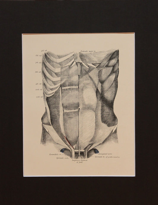 Matted Antique (c.1897) Anatomy Print, Plate XLVII: Anterior Abdominal Wall