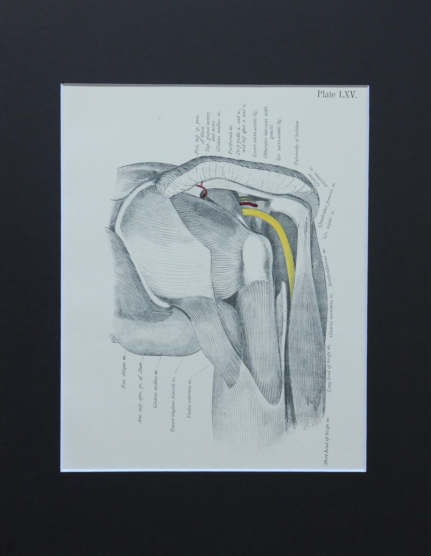Matted Antique (c.1897) Anatomy Print, Plate LXV: Hip Joint, Lateral View