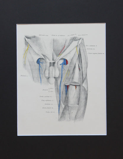Matted Antique (c.1897) Anatomy Print, Plate LXVII: Hip Joint Region & Penis