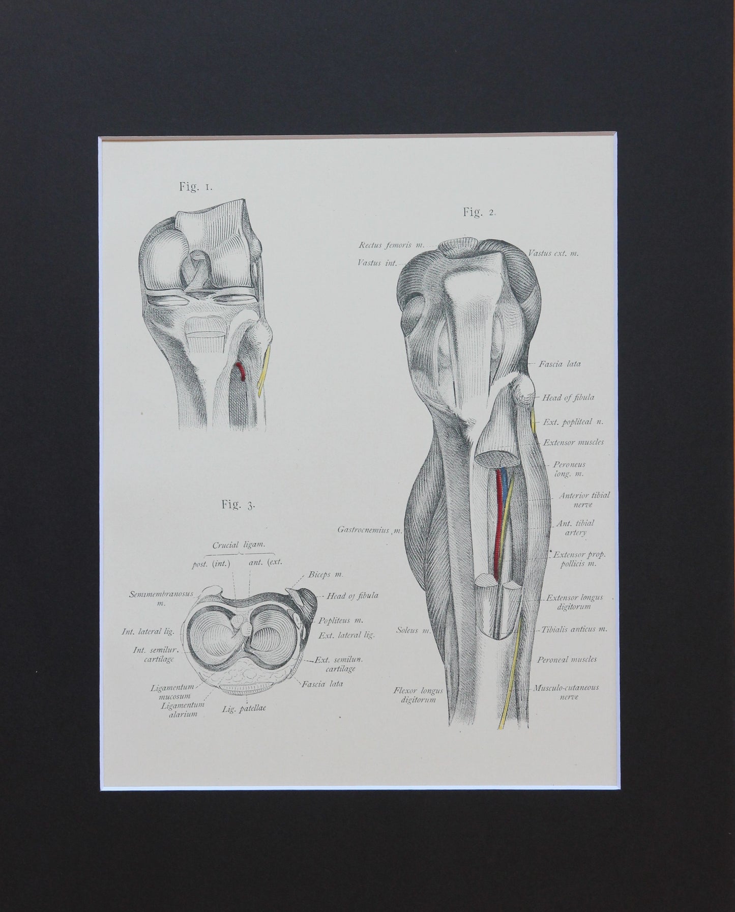 Matted Antique (c.1897) Anatomy Print, Plate LXIX: The Knee Joint