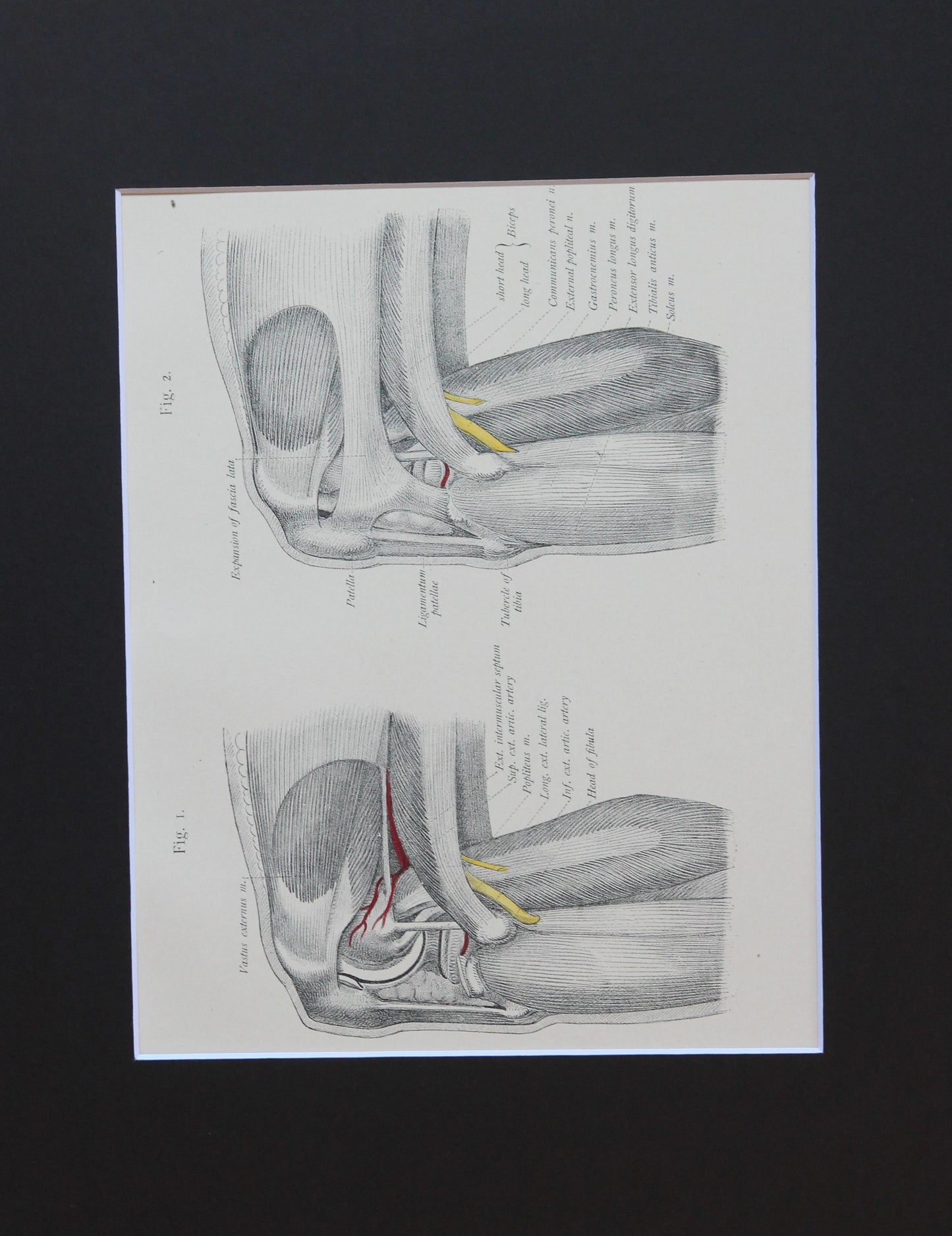 Matted Antique (c.1897) Anatomy Print, Plate LXXIII: The Knee Joint, Outer Side
