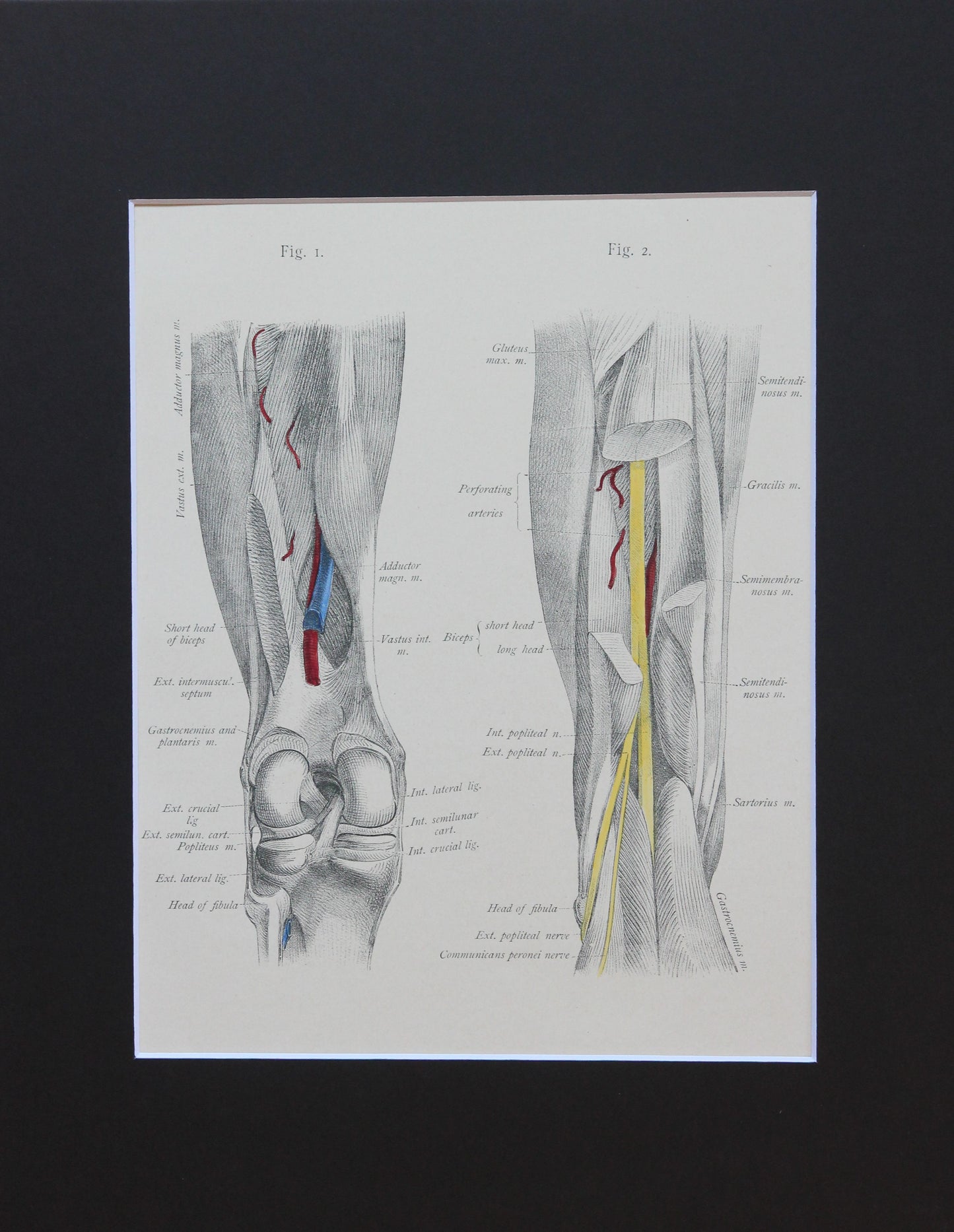Matted Antique (c.1897) Anatomy Print, Plate LXXIV: The Thigh & Knee Joint
