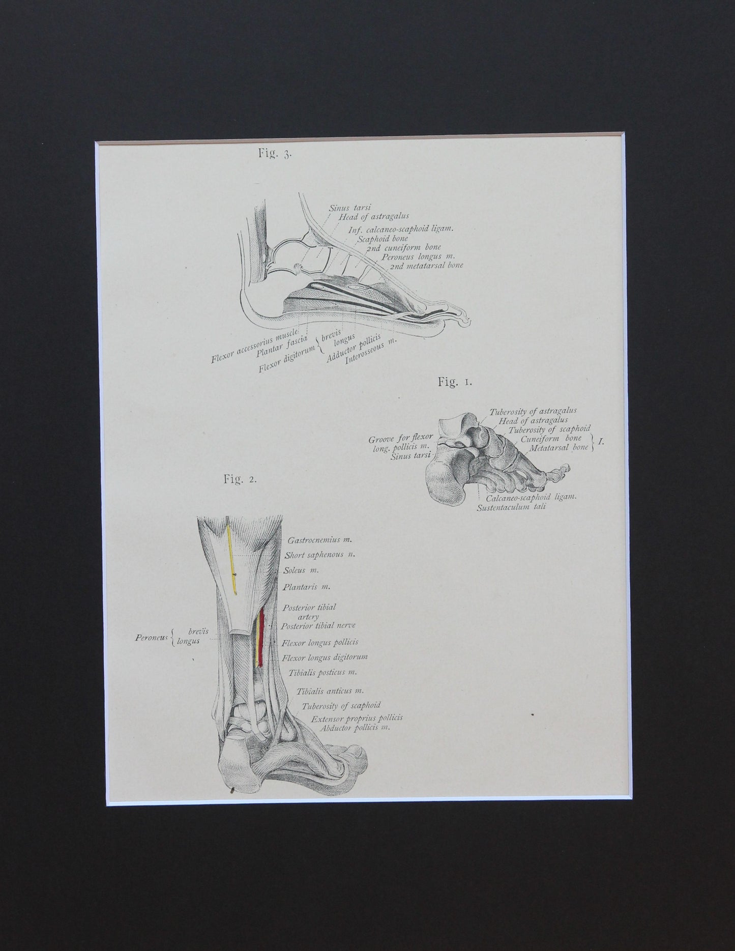 Matted Antique (c.1897) Anatomy Print, Plate LXXVII: The Foot, Skeleton & Muscles
