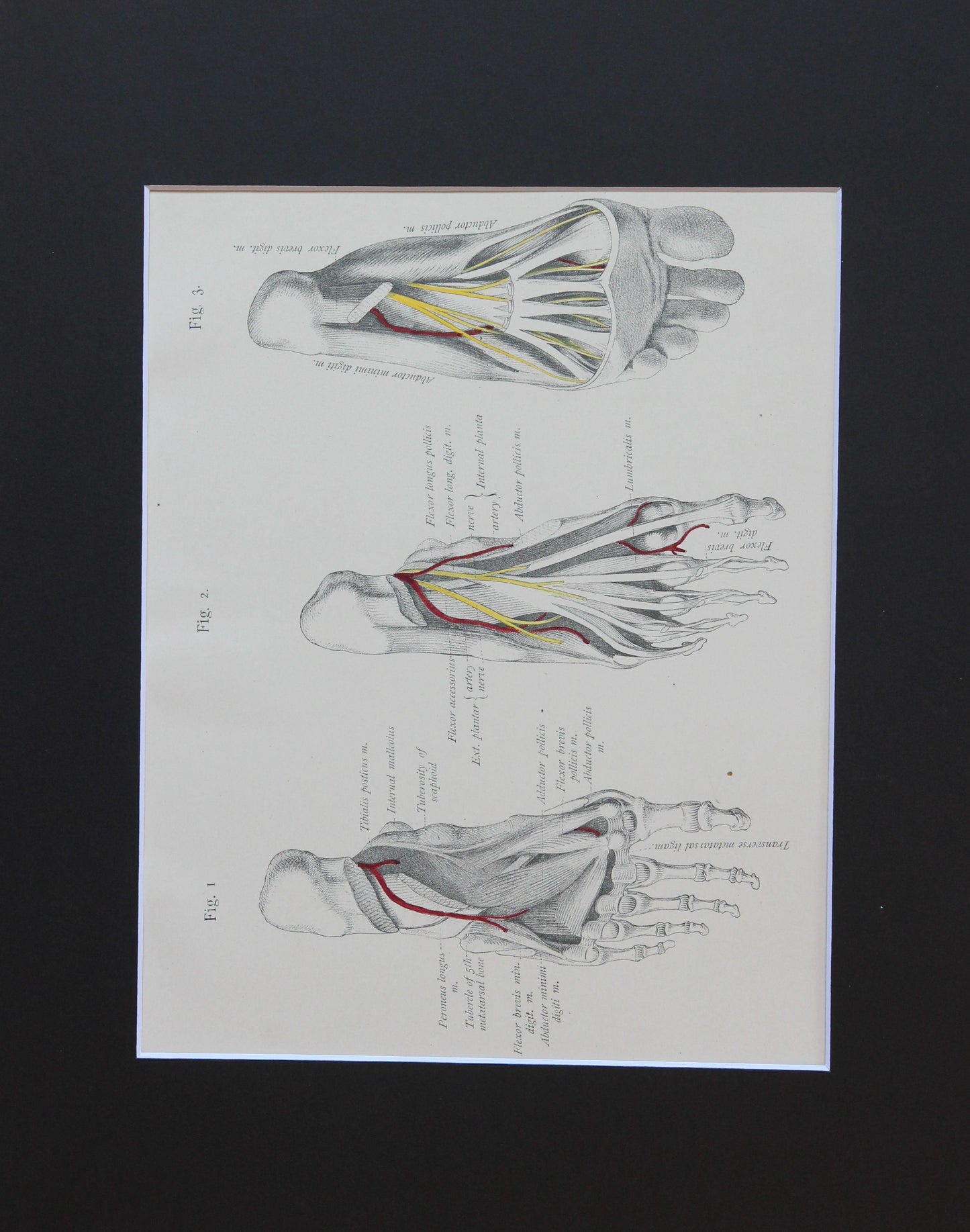 Matted Antique (c.1897) Anatomy Print, Plate LXXXI: The Sole of the Foot