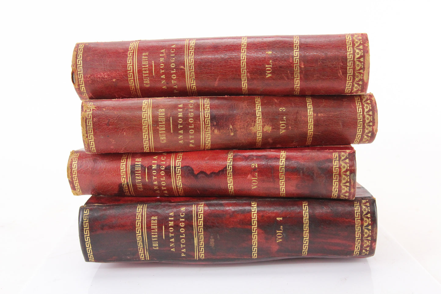 Anatomia Patologica (Pathological Anatomy) by Jean Cruveilhier, Volume 1-4, 1838
