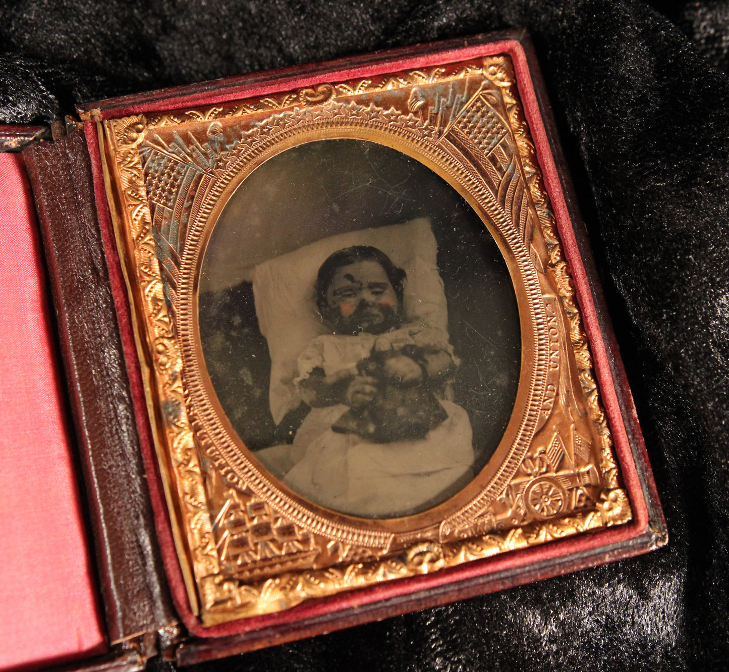 Post Mortem Ambrotype of a Baby with Burn Injuries in Full Union Case, Sixth-Plate