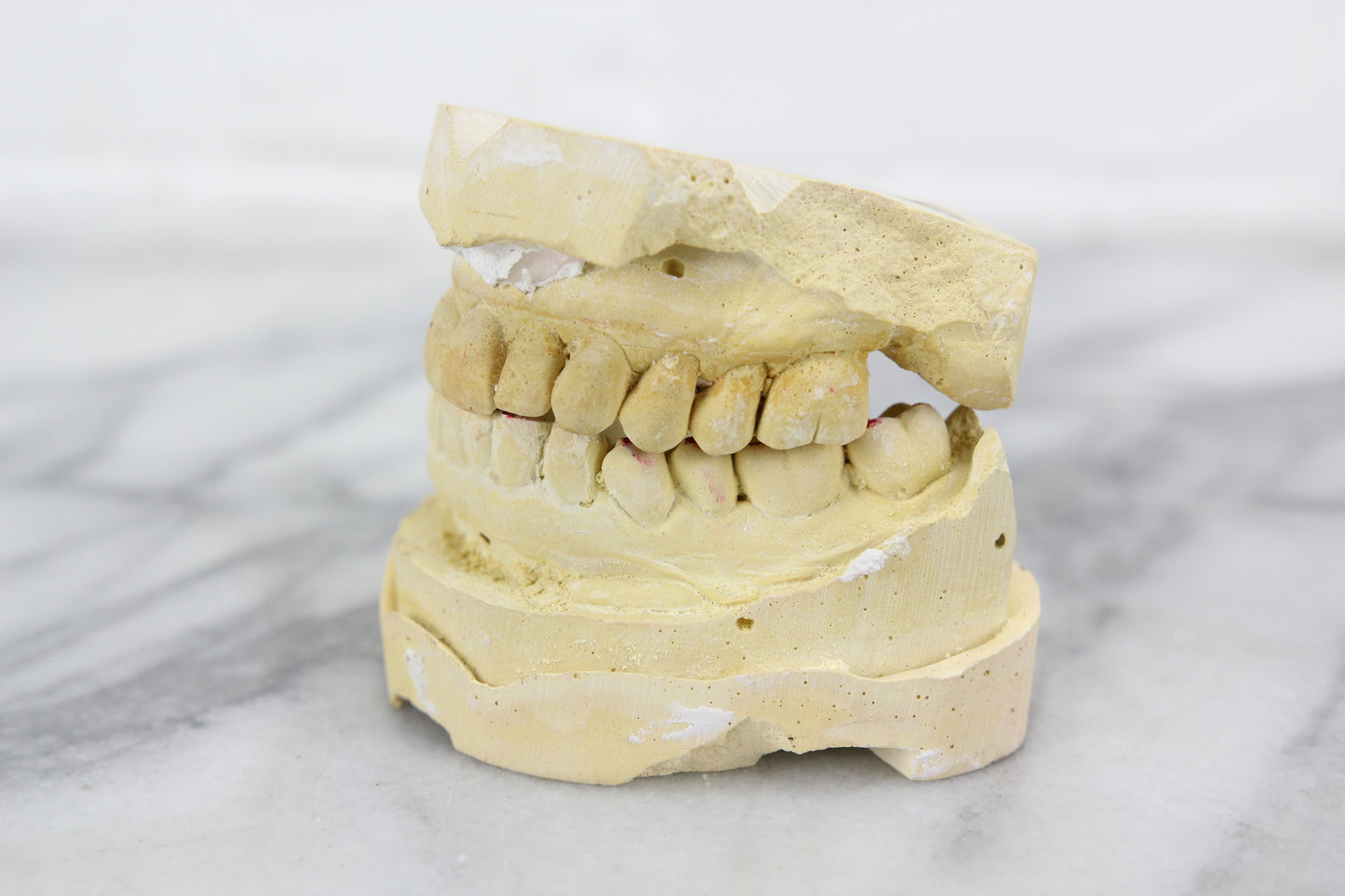 Genuine Dental Mold of My Friend Janet's Teeth