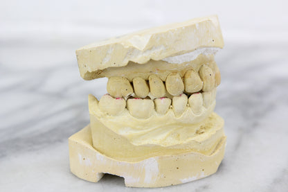 Genuine Dental Mold of My Friend Janet's Teeth